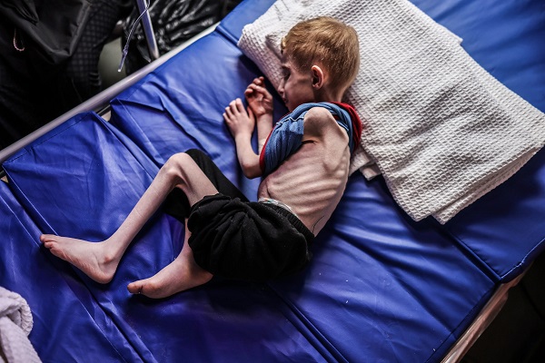 Famine in Gaza 2