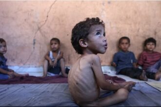 Gaza Starving children