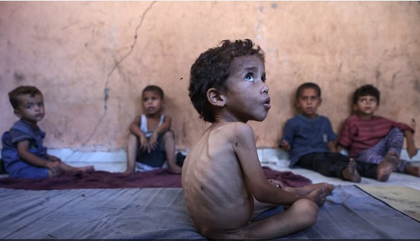 Gaza Starving children