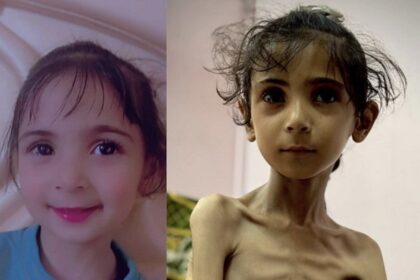 Gaza famine