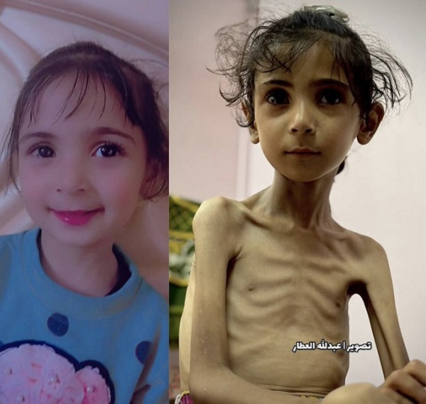 Gaza famine