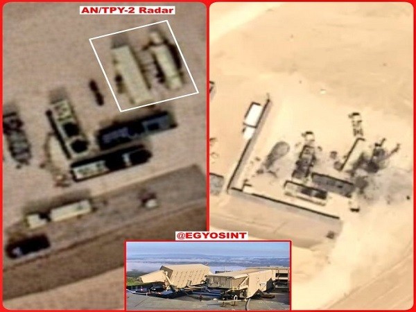 US radar
